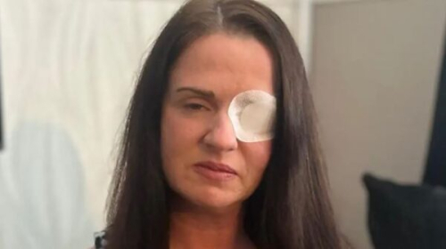 “Tuve un paro cardíaco y casi me quedé ciega después de que una esteticista me pusiera bótox falso”